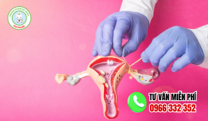 Cách phục hồi tử cung sau phá thai