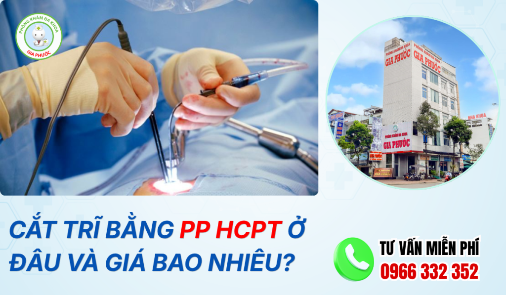 Cắt trĩ bằng phương pháp hcpt ở đâu