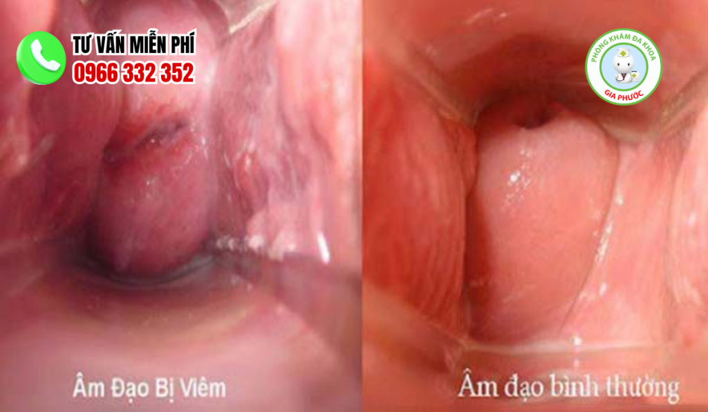 Cấu tạo hình ảnh âm đạo