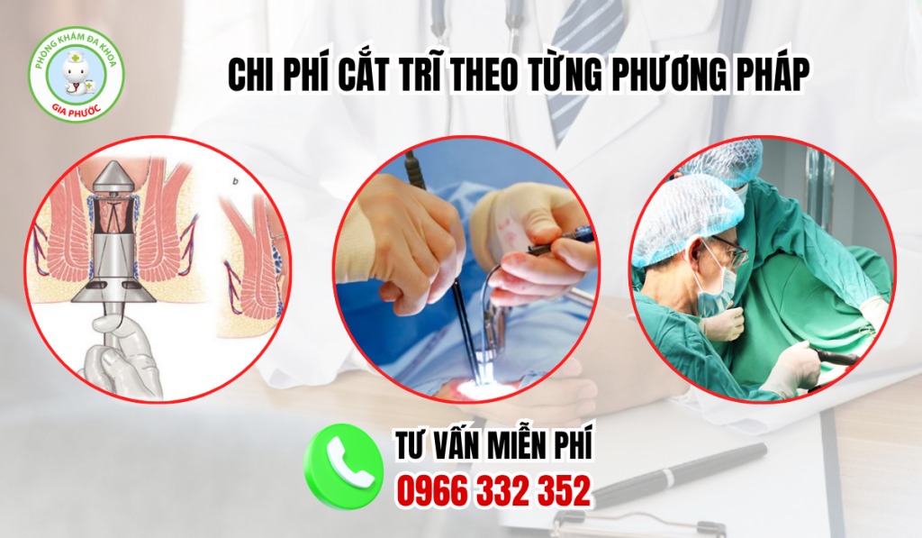 Cắt trĩ hết bao nhiêu tiền