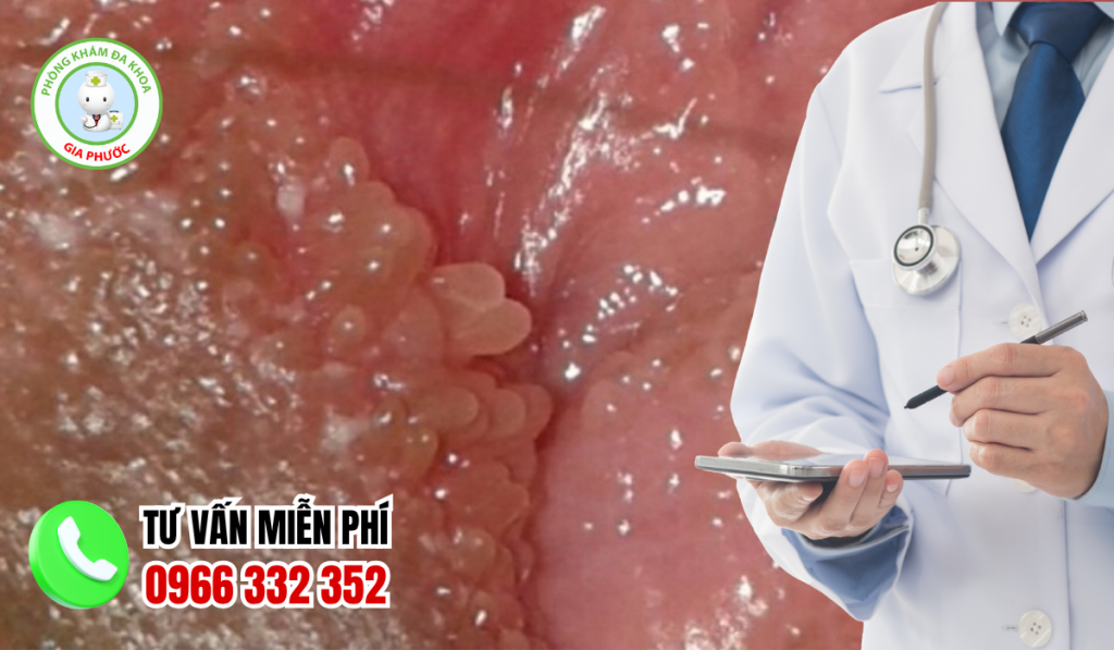Gai sinh dục có tự hết không