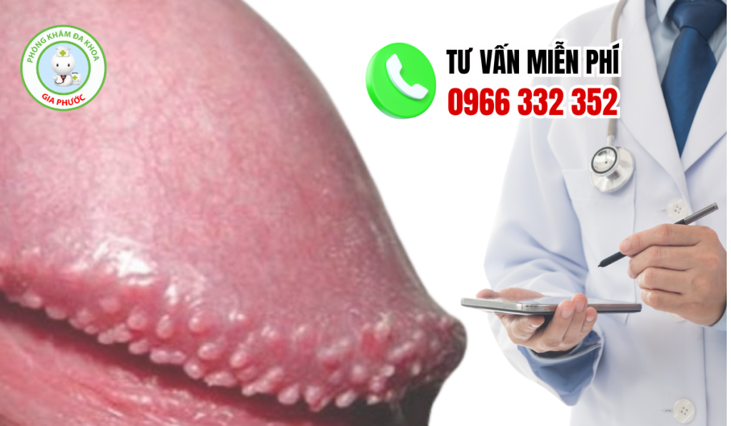 Gai Sinh Dục Nam Là Gì? Hình Ảnh, Nguyên Nhân Và Cách Trị (2026) 4 Hình ảnh gai sinh dục nam