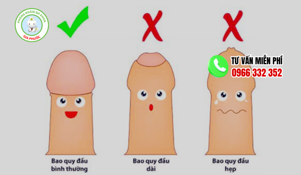 Hình ảnh trẻ hẹp bao quy đầu bình thường