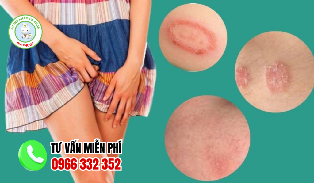 Ngứa vùng kín càng gãi càng ngứa: Nguyên nhân và cách điều trị