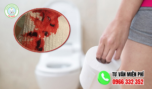 Nóng trong người đi cầu ra máu