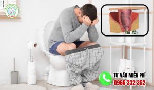 Sau mỗ trĩ đi cầu nhiều lần có sao không