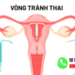 Ưu Và Nhược Điểm Khi Đặt Vòng Tránh Thai