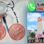 Địa chỉ điều trị sùi mào gà hậu giang uy tín