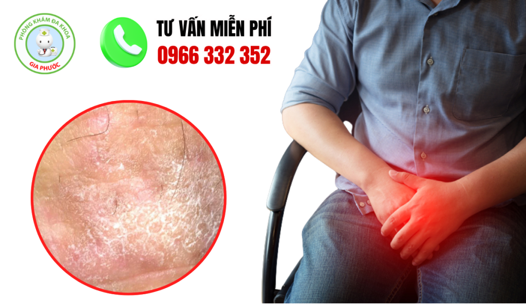 30 Hình Ảnh Bìu Bình Thường Và Bất Thường Ở Nam Giới 5 Hình ảnh bìu bình thường