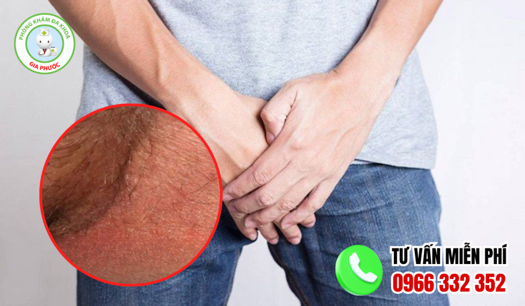 30 Hình Ảnh Bìu Bình Thường Và Bất Thường Ở Nam Giới 4 Hình ảnh bìu bình thường