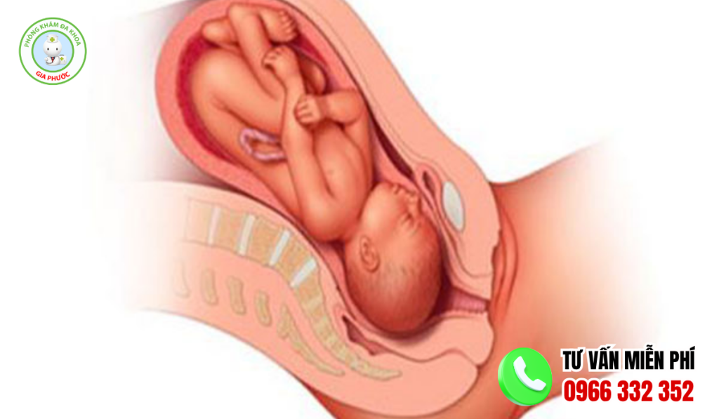 Hình ảnh cổ tử cung mở 4-7cm
