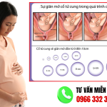 Tổng hợp hình ảnh cổ tử cung mở theo từng cm và dấu hiệu sắp sinh thực tế