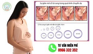 Tổng hợp hình ảnh cổ tử cung mở theo từng cm và dấu hiệu sắp sinh thực tế