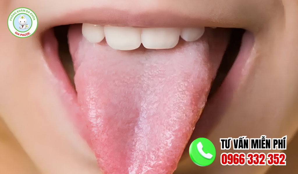 Hình ảnh gai lưỡi bình thường