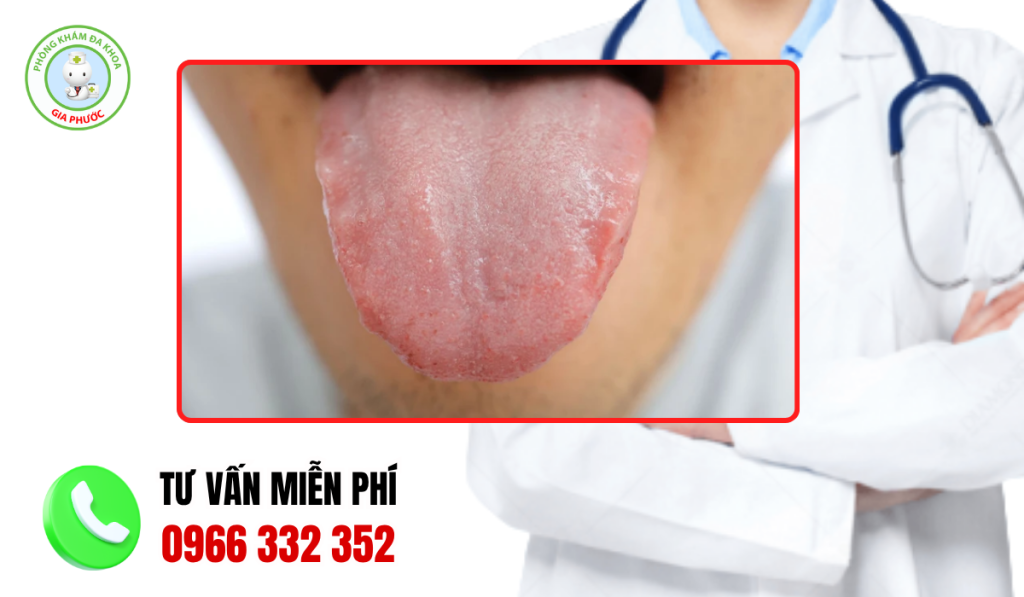Hình ảnh gai lưỡi bình thường