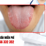 Hình ảnh gai lưỡi bình thường