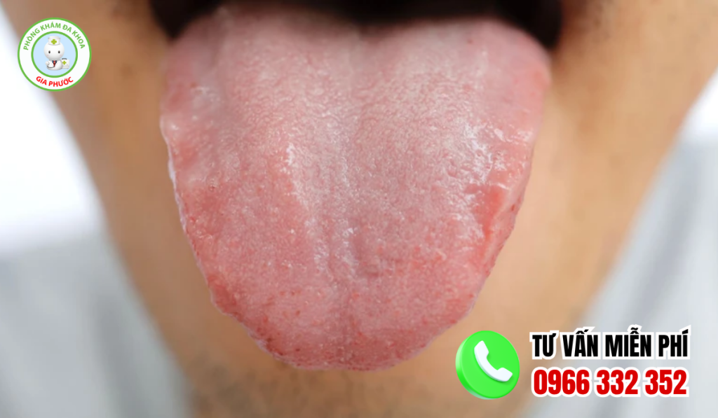 Hình ảnh gai lưỡi bình thường