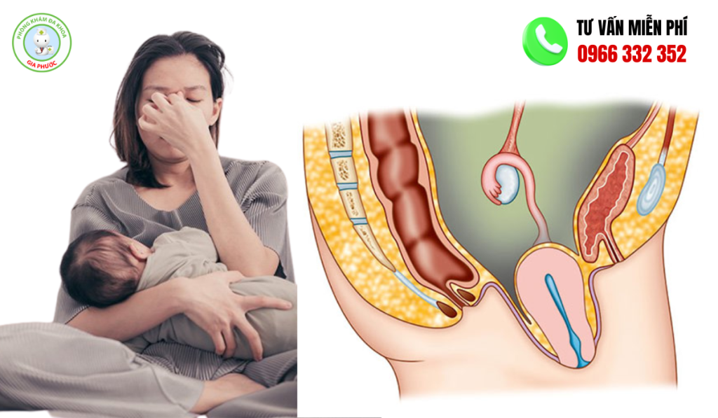 Hình ảnh sa tử cung độ 1