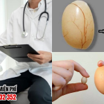 20+ Hình Ảnh Teo Tinh Hoàn Ở Người Lớn Và Trẻ Em Chân Thật 9 Hình ảnh teo tinh hoàn