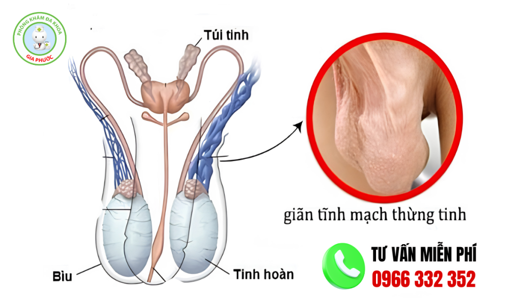 Hình ảnh tinh hoàn bất thường