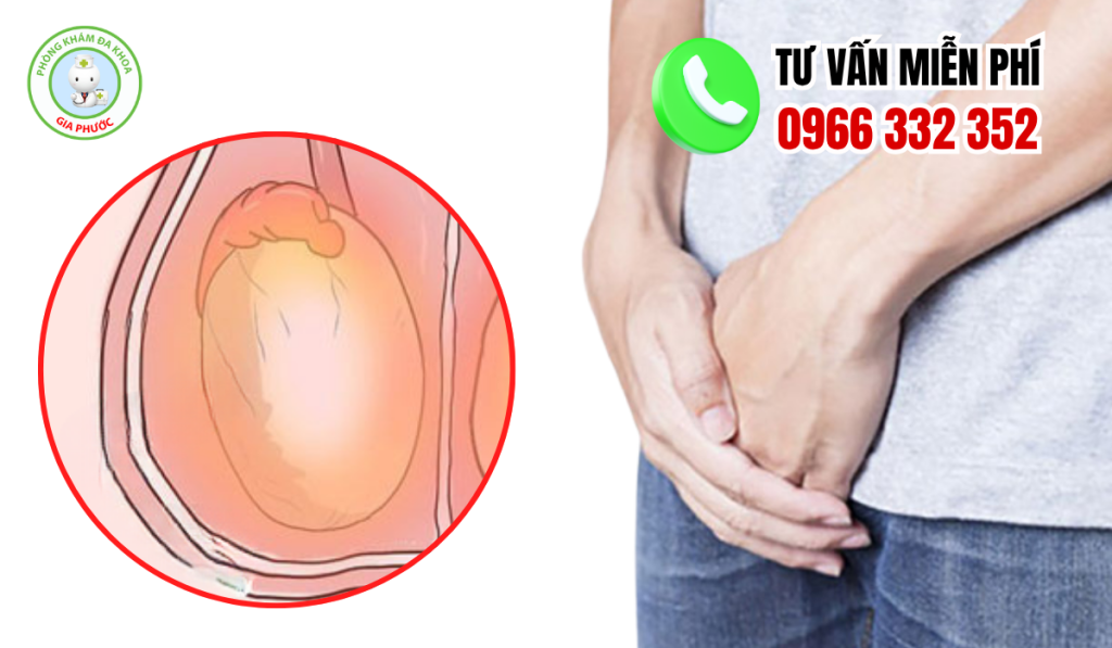 hình ảnh tinh hoàn bình thường