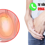 hình ảnh tinh hoàn bình thường