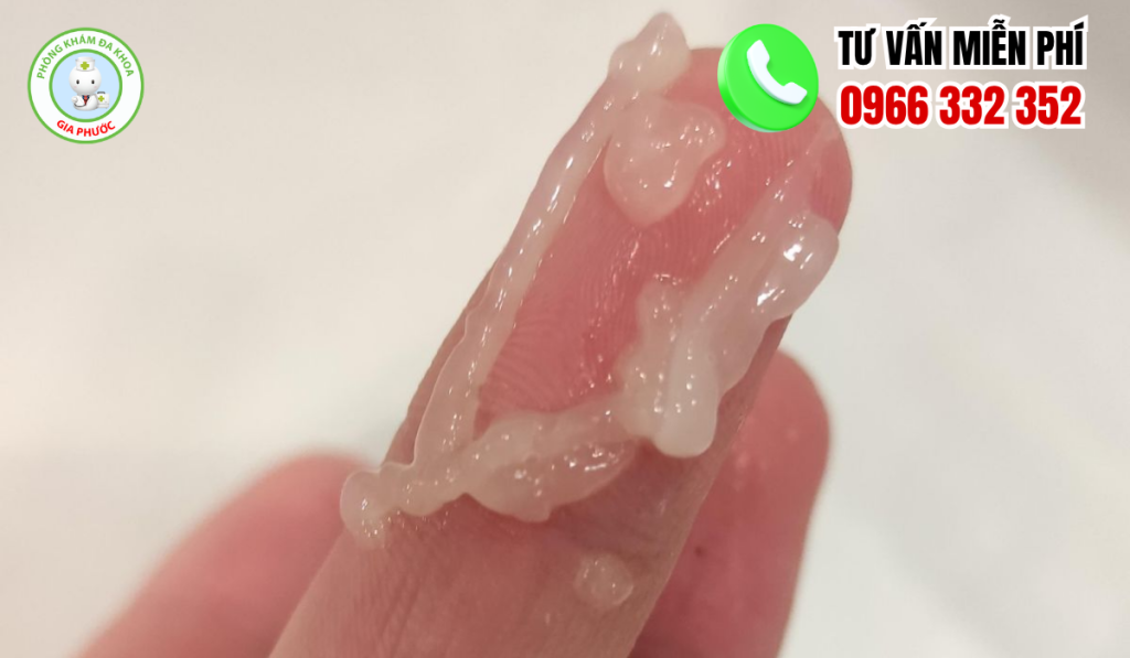 20 Hình Ảnh Tinh Trùng Vón Cục Như Thạch Ở Nam Giới Và Cách Chữa 5 Hình ảnh tinh trùng vón cục như thạch