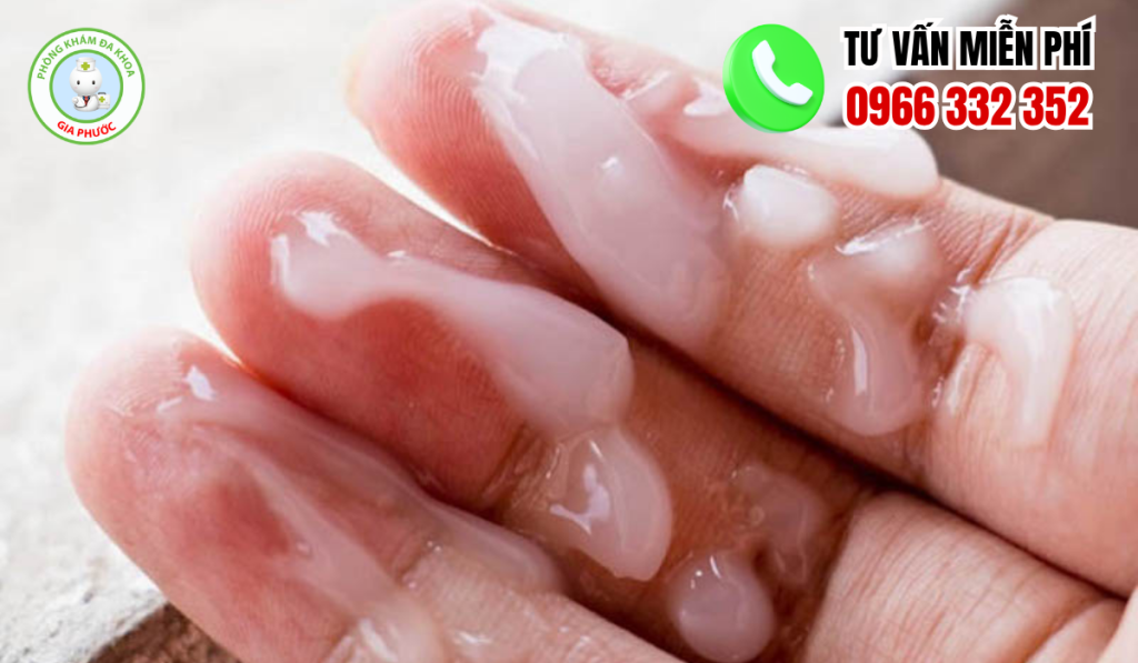 20 Hình Ảnh Tinh Trùng Vón Cục Như Thạch Ở Nam Giới Và Cách Chữa 3 Hình ảnh tinh trùng vón cục như thạch