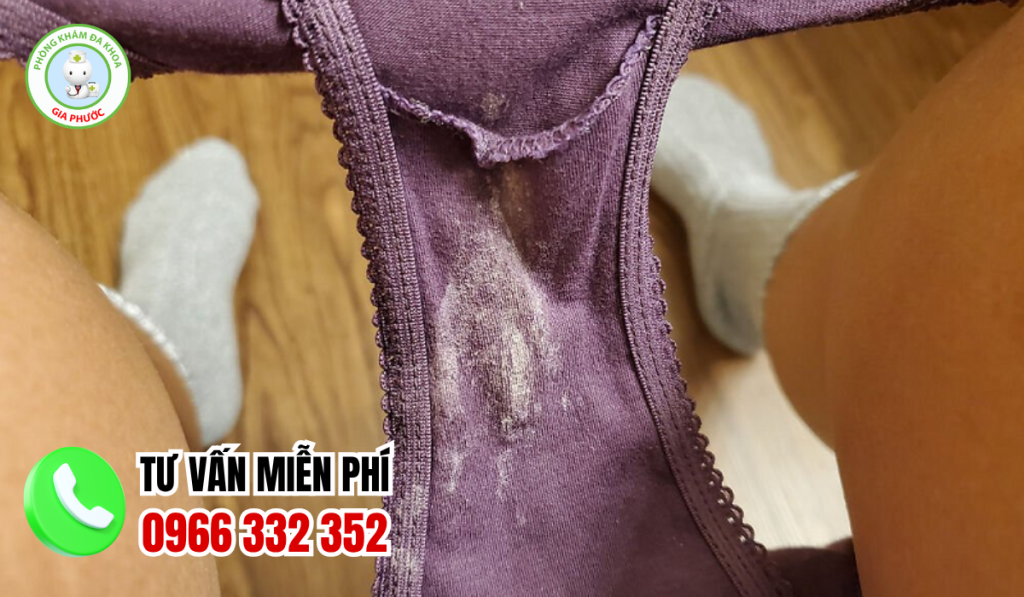 Hình Ảnh Viêm Phụ Khoa Ở Nữ Giới Và Cách Điều Trị Dứt Điểm 6 Hình ảnh viêm phụ khoa nữ giới