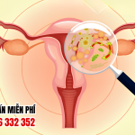 Hình Ảnh Viêm Phụ Khoa Ở Nữ Giới Và Cách Điều Trị Dứt Điểm 6 Hình Ảnh Viêm Phụ Khoa Ở Nữ Giới Và Cách Điều Trị Dứt Điểm