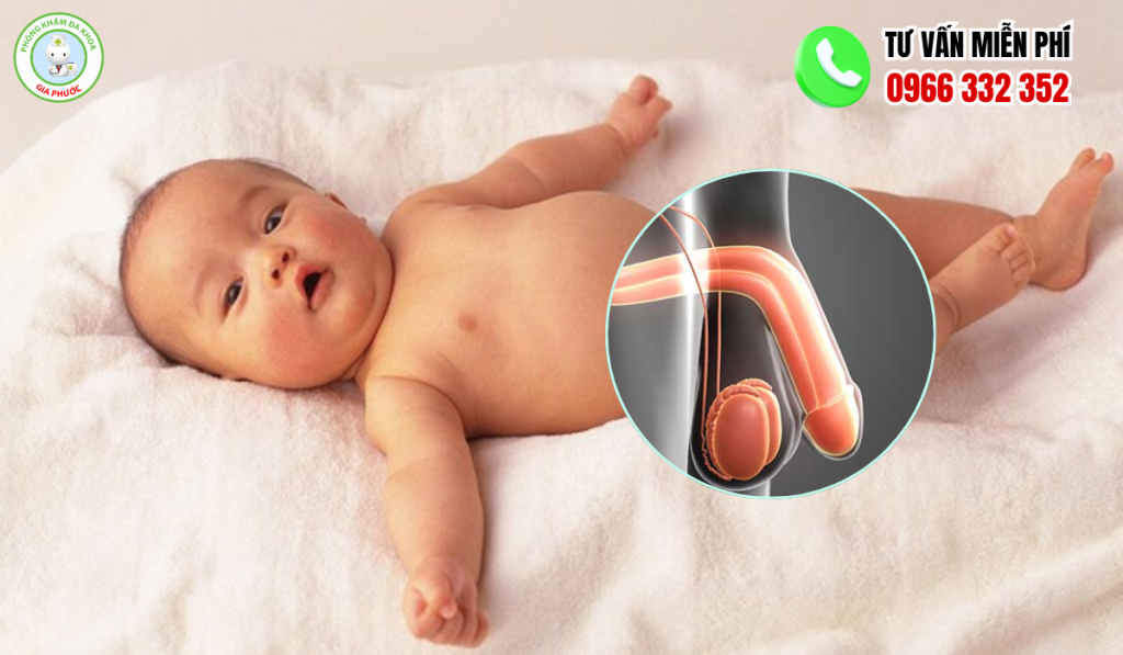 hình ảnh tinh hoàn bình thường ở trẻ sơ sinh