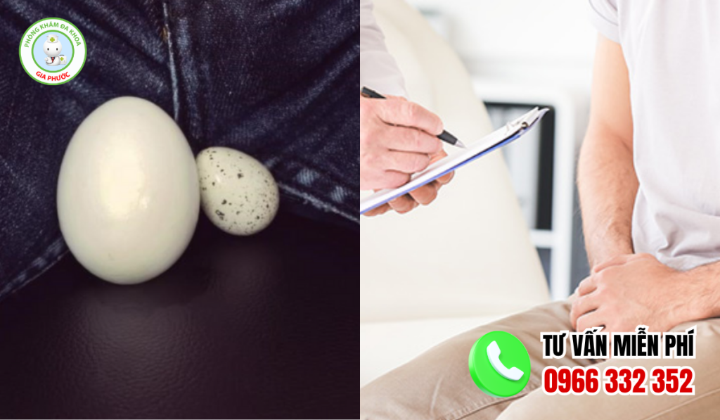 Thế nào là hình ảnh teo tinh hoàn