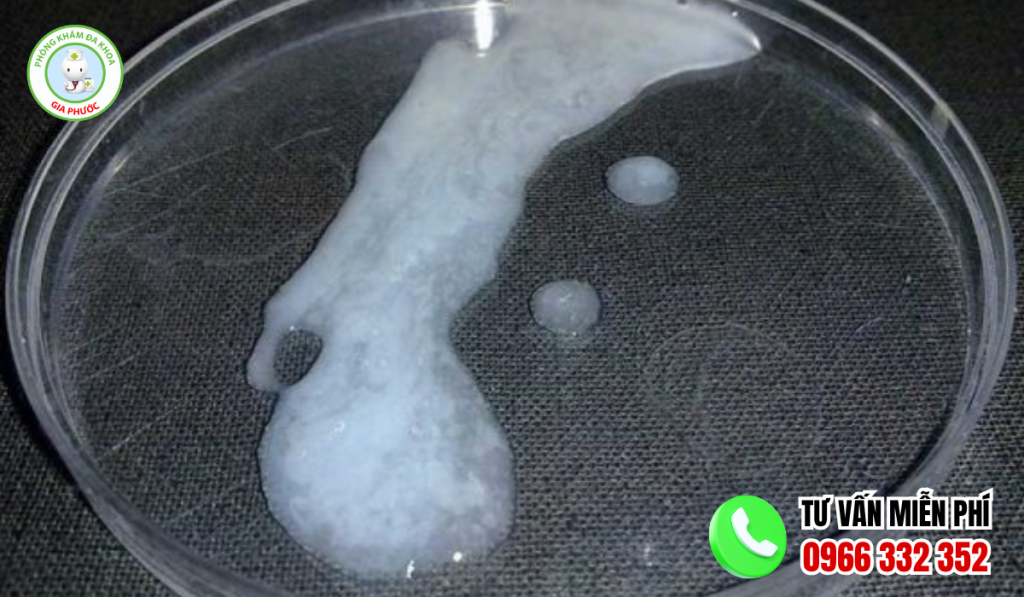 Hình ảnh tinh dịch bình thường sau khi xuất tinh ở nam giới