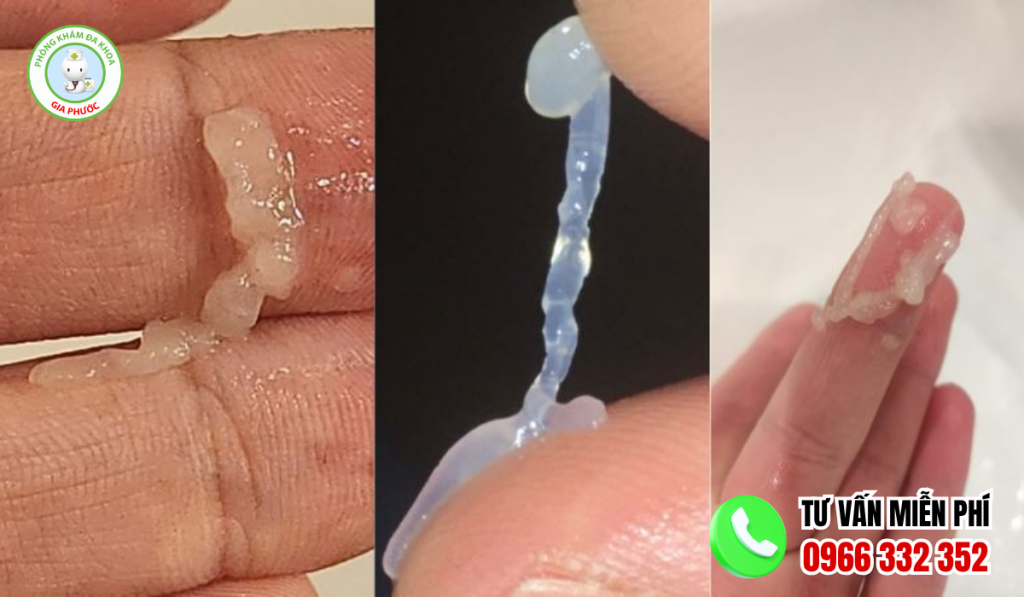Hình ảnh tinh dịch vón cục trong suốt như thạch gelatin