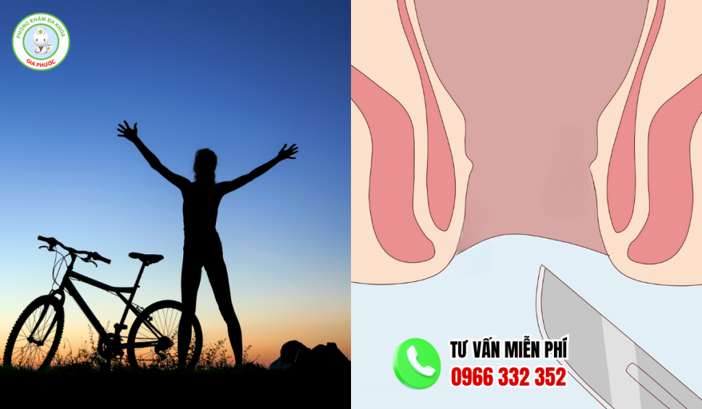 Hình ảnh hậu môn bình thường và hậu môn bị trĩ