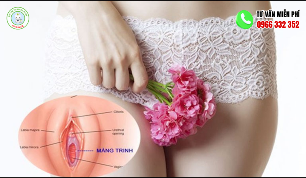 Các loại màng trinh