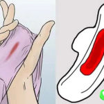 Cách nhanh hết sản dịch sau khi hút thai