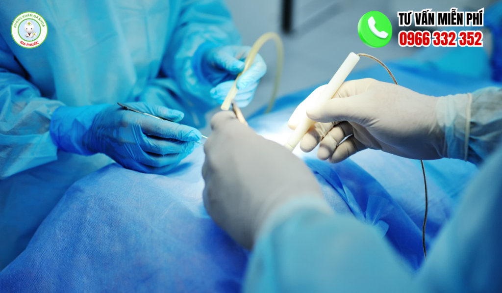 Giải Đáp Y Khoa: Cắt Trĩ Nhiều Lần Có Sao Không? 2 Cắt trĩ nhiều lần có sao không