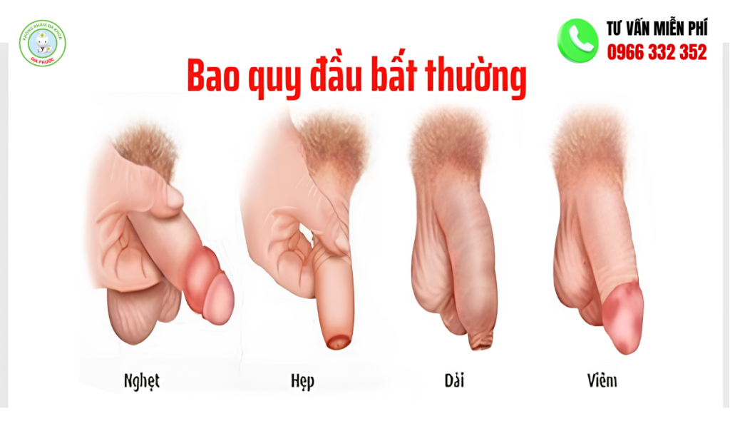 Hình Ảnh Bao Quy Đầu Bình Thường Ở Người Lớn Trực Quan 4 Hình ảnh bao quy đầu bình thường ở người lớn