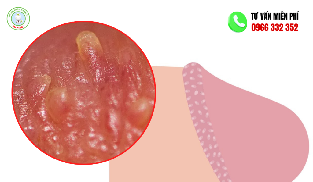 50+ Hình Ảnh Chuỗi Hạt Ngọc Ở Nam Giới 2 Hình ảnh chuỗi hạt ngọc ở nam giới