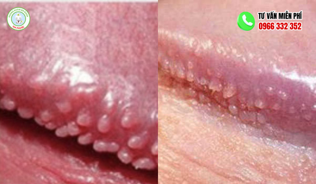 50+ Hình Ảnh Chuỗi Hạt Ngọc Ở Nam Giới 3 Hình ảnh chuỗi hạt ngọc ở nam giới