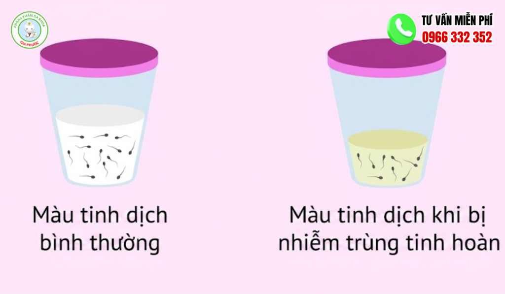 Hình ảnh tinh trùng bình thường