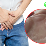 Hình Ảnh Tinh Trùng Loãng: Nhận Biết, Cách Điều Trị 13 Hình ảnh tinh trùng loãng