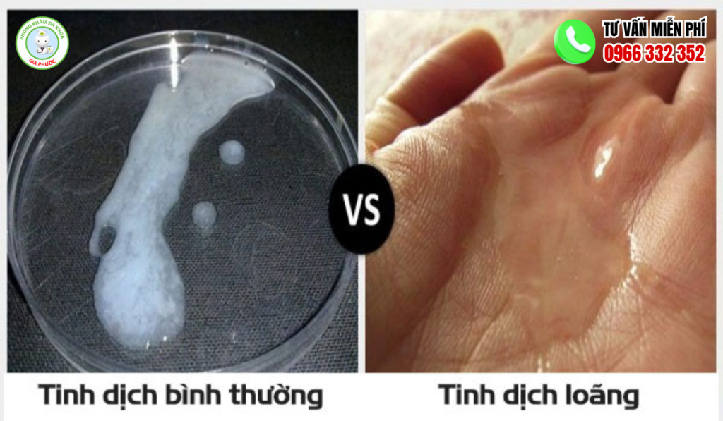 Hình Ảnh Tinh Trùng Loãng: Nhận Biết, Cách Điều Trị 4 Hình ảnh tinh trùng loãng