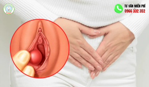 Hình ảnh nổi mụn ở mép vùng kín nữ