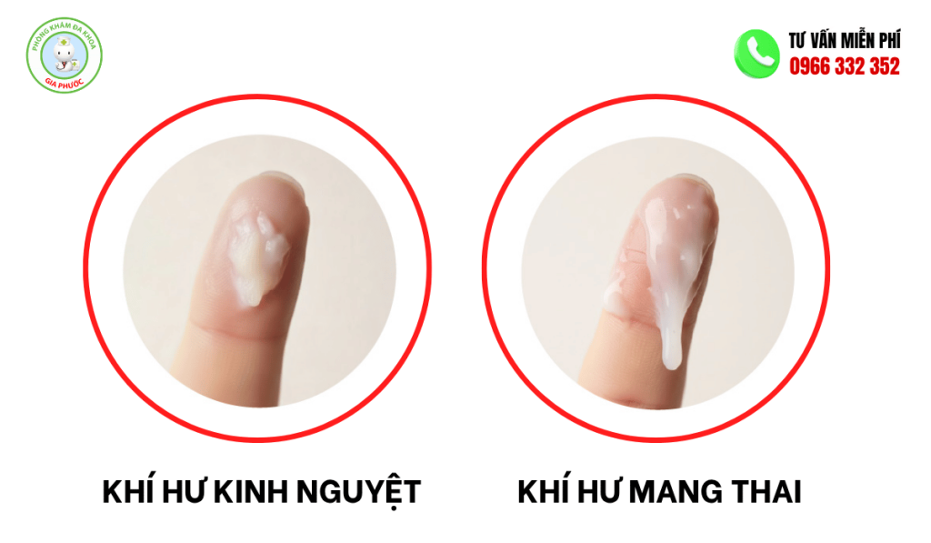 Khí Hư Kinh Nguyệt Và Khí Hư Mang Thai Và Cách Phân Biệt 2 Phân biệt khí hư kinh nguyệt và khí hư manhg thai
