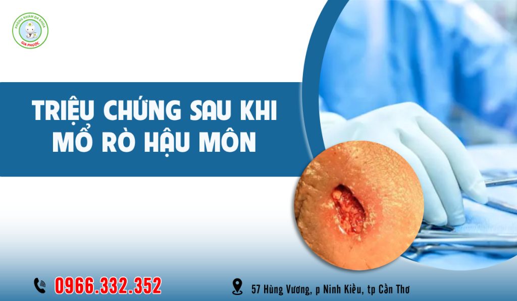 Các triệu chứng sau khi mổ rò hậu môn