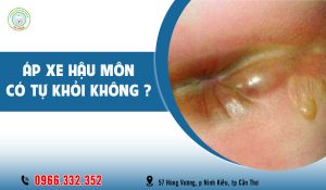 Áp xe hậu môn có tự khỏi không?