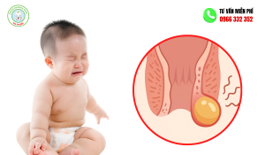 Áp xe hậu môn ở trẻ sơ sinh
