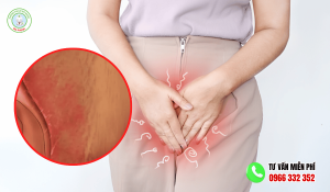 Cách trị ngứa 2 bên mép vùng kín tại nhà